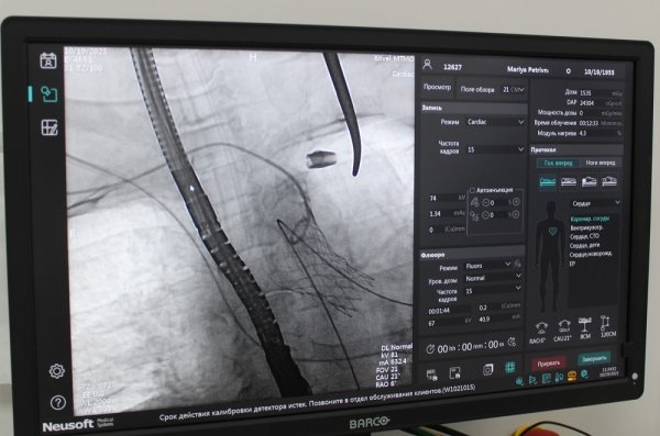 У Ковелі провели першу на Волині операцію TAVI без розрізу грудної клітини У Ковелі провели першу на Волині операцію TAVI без розрізу грудної клітини