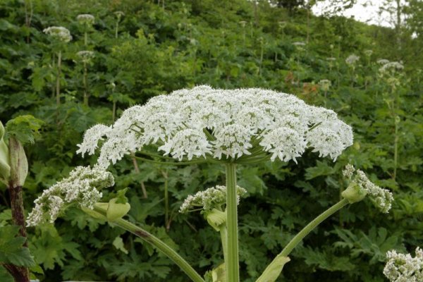 У Ковелі пацієнта з опіками борщівником госпіталізовано в реанімаційне відділення