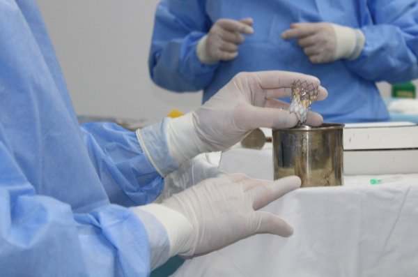 У Ковелі провели першу на Волині операцію TAVI без розрізу грудної клітини У Ковелі провели першу на Волині операцію TAVI без розрізу грудної клітини