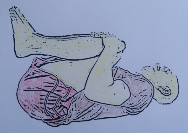 Вправи від гемороя, які ефективно вирішують причину його виникнення