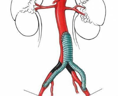 У Ковелі провели складну унікальну операцію У Ковелі провели складну унікальну операцію