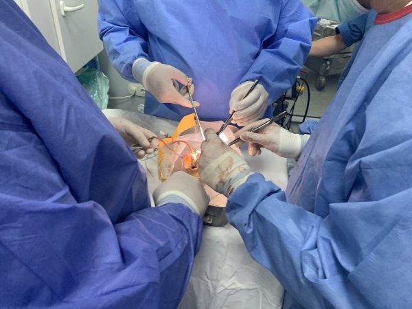 Вперше в Україні унікальний випадок трансплантації серця виконали у Ковелі ФОТО